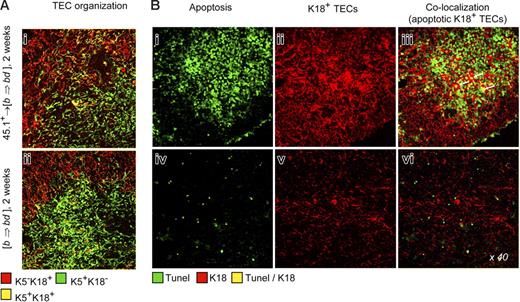 Figure 6. Abnormal TEC organization and TEC apoptosis following inactivation of host-type pAPCs. (A) Lack of a regular TEC organization in the BM chimeras described in Figure 5, as demonstrated by altered intracellular expression of K5 and K1825 at 2 weeks. (B) For analysis of apoptotic TECs, thymic sections were stained as in Figure 1. Colocalization of TUNEL and K18 depicts apoptotic TEC (arrows in panel iii). Four individual experiments were performed, with 2 to 4 animals per group and experiment. These experiments yielded comparable results, and therefore a representative photomicrograph of one mouse for each group is shown.