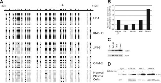 Figure 1. The SOD2 promoter is methylated in MM and correlates with decreased expression of SOD2. (A) The SOD2 promoter from −205 to +125, relative to the transcriptional start site, was screened by sodium bisulfite sequencing to determine methylated cytosines. The relative positions of the methylated cytosines are indicated by slash marks. Sequncing results from 10 clones are shown where • represents a methylated cytosine, whereas ○ represents an unmethylated cytosine. (B) The expression level of SOD2, as measured by DNA microarrays, is shown normalized to the expression of SOD2 in normal plasma cells. (C) Western blot showing expression of SOD2 in myeloma cell lines. Actin serves as the loading control. (D) Expression levels of SOD2 in cell lines treated with the demethylating agent zebularine. Actin serves as the loading control.