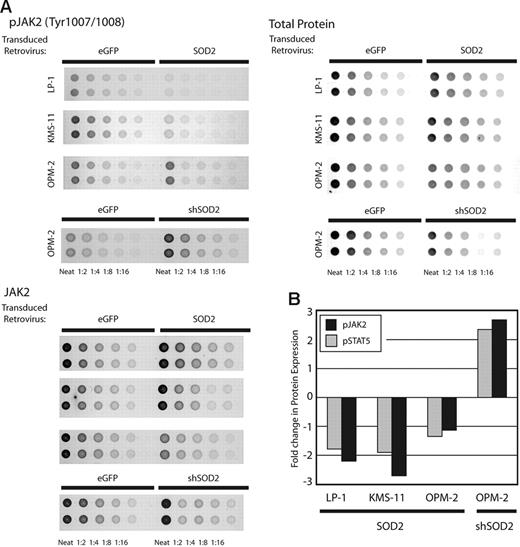 Figure 7. RPAs using cell lines with manipulated SOD2 levels. The levels of phosphorylated JAK2 and STAT5 were determined using RPAs and cell lines with manipulated SOD2 expression. (A) Results of 3 arrays for the detection of phosphorylated JAK2, total JAK2, and colloidal gold staining for total protein are shown. (B) Quantitation of JAK2 and STAT5 phosphorylation. The values obtained using linear regression for phosphorylated JAK2 and STAT5 were normalized to total protein printed, which was then normalized to total JAK2 and STAT5 expression, respectively. The fold change in phosphorylated values for SOD2-manipulated lines versus the corresponding control is presented.