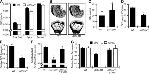 Figure 1. B-cell KO mice display decreased baseline BMD and increase bone resorption, concurrent with decreased BM OPG concentrations. (A) BMD was determined by DXA in μMT/μMT B-cell KO mice (□) and age-matched WT controls (▪) at the total body, spine, and femurs. (B) Longitudinal (top) and cross-sectional (bottom) μCT reconstructions of distal femurs from WT and μMT/μMT B-cell KO mice. (C) Elevated biochemical indices of bone resorption (CTx) were observed in B-cell KO mice. (D) Decreased OPG production was detected in μMT/μMT B-cell KO BM compared with equivalent amounts of WT BM. Mean ± SD of 8 mice per group; *P < .05. (E) Real-time RT-PCR quantitation of OPG mRNA expression in 3 independent WT and B-cell KO mice. *P < .01. (F) B-cell reconstitution of μMT/μMT B-cell KO rescues BMD (*P < .01 versus WT) and (G) OPG production (*P < .05 versus WT). Mice were reconstituted at 4 weeks of age and BMD and RT-PCR studies preformed at 12 weeks of age.