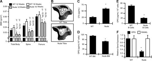 Figure 3. T-cell–deficient nude mice display decreased baseline BMD and increased bone resorption, concurrent with decreased total BM OPG, and B-cell–specific OPG production. (A) BMD was determined in WT mice at the total body, spine, and femurs, 12 weeks of age (black bars) and 16 weeks of age (white bars), and in nude mice at 12 weeks of age (vertical lines) and 16 weeks (horizontal lines) of age. Data are presented as mean ± SD of 29 nude mice and 18 WT mice. *P ≤ .001 relative to age-matched WT. Percentage changes (Δ) between nude and WT mice at 12 and 16 weeks are indicated above the appropriate bars. (B) μCT reconstructions showing reduced trabecular and cortical structure of representative tibias in nude mice relative to WT. (C) Increased biochemical indices of bone resorption (CTx) were observed in the serum of nude mice compared with WT. *P < .05; n = 9 mice per group. (D) Decreased OPG production by BM derived from nude mice compared with WT (ELISA). (E) Decreased OPG production by purified IgM+ B cells from nude mice relative to WT, quantitated in 48-hour–conditioned medium by ELISA; n = 6 mice per group. *P ≤ .01. (F) Real-time RT-PCR quantitation of OPG and RANKL mRNA expression in WT and nude mice. Mean ± SD of 3 independent WT and nude mice. *P < .01.