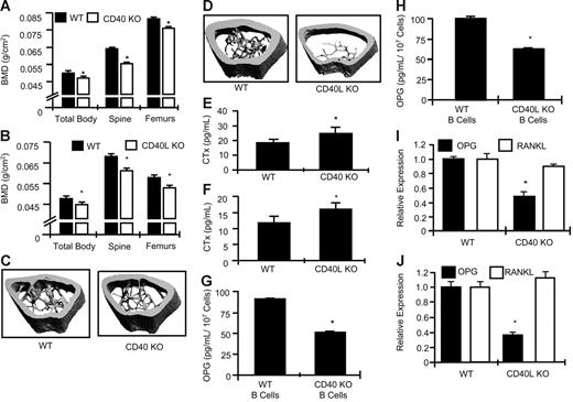 Figure 4. CD40 KO mice and CD40L KO mice display decreased baseline BMD and increased bone resorption, concurrent with decreased B-cell OPG production. Decreased BMD was observed by DXA in (A) CD40 KO mice and (B) CD40L KO mice relative to age-matched (24 weeks) WT controls of the same genetic background at multiple anatomic positions including total body, spine, and femurs. P < .01, n = 16 (WT), n = 14 (CD40 KO), n = 12 (WT and CD40 KO). μCT reconstructions showing reduced trabecular and cortical structure of representative femurs in (C) CD40 KO mice and in (D) CD40L KO mice relative to their respective WT controls. Increased biochemical indices of bone resorption (CTx) were observed in the serum of (E) CD40 KO mice and (F) CD40L KO mice. Decreased OPG production by IgM+ BM B cells derived from (G) CD40 KO mice and (H) CD40L KO mice compared with WT (ELISA). *P ≤ .001. Real-time RT-PCR quantitation of OPG and RANKL mRNA expression in (I) CD40 KO and (J) CD40L KO mice. Mean ± SD of 3 independent WT and CD40 KO mice. *P ≤ .01.