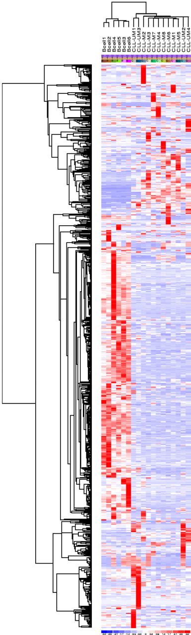 Figure 1. Unsupervised hierarchical clustering of the basal gene expression discriminates CLL B cells from healthy B cells. Five hundred eight marker probe sets were statistically differentially expressed (P = .05) in CLL patients compared to healthy donors.