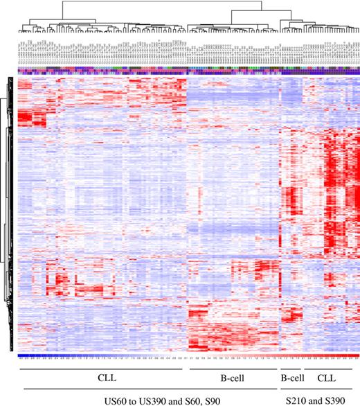 Figure 2. Functional gene expression after BCR cross-linking. Each time point is shown as a column, with 4 time points for unstimulated and 4 time points for stimulated cells, for each of the 18 subjects (6 healthy and 12 CLL patients) for a total of 144 DNA chips. Nine hundred twenty-five of 54 675 probe sets satisfied the filtering criteria. Unsupervised hierarchical clustering analysis of functional gene expression after BCR cross-linking.