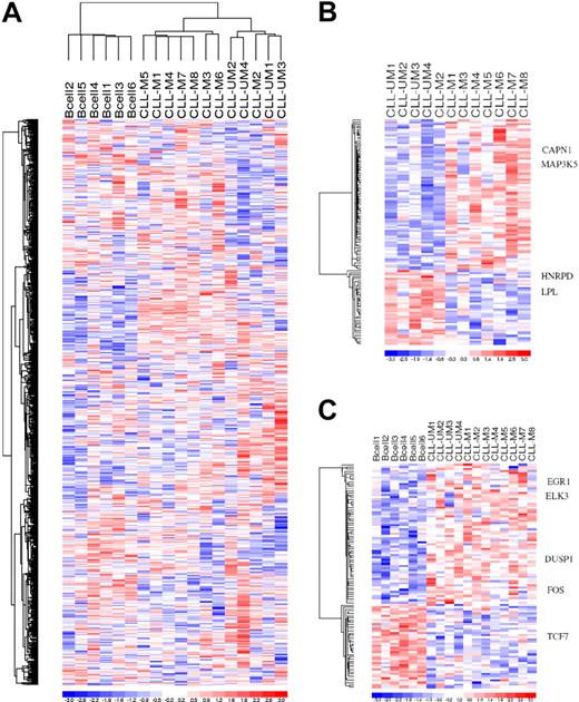 Figure 3. Linear combination of marker probe sets. (A) Unsupervised linear combination of expression of the 18 subjects over 4 time points after BCR crosslinking. Eight hundred sixty of 54 675 probe sets satisfied the filtering criteria. (B) Probe sets differentially expressed over time between UM-CLL Zap+ B cells and M-CLL Zap− B cells. One hundred eighteen of 54 675 probe sets satisfied the filtering criteria. (C) Probe sets differentially expressed over time between healthy B cells and CLL patient marker genes. One hundred four of 54 675 probe sets satisfied the filtering criteria.