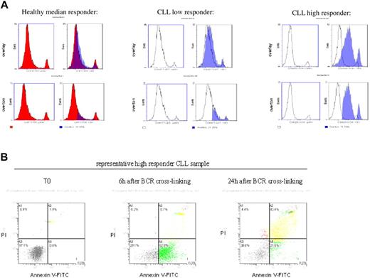 Figure 6. BCR cross-linking and apoptosis. (A) Apoptosis assessed by Annexin V–FITC staining for 1 healthy control and 2 CLL patients (nonresponder and high responder). (Top and bottom left) Time before stimulation (T0). (upper right) Overlay unstimulated (T0) and stimulated (T6H, in translucent blue). (Bottom right) Integration of the 2 curves unstimulated and stimulated (T6H), calculation of the percentage of cells undergoing apoptosis after stimulation compared to basal (Overton). (B) Flow cytometry analysis of Annexin V–FITC and propidium iodine double staining before stimulation (T0), at 6 hours, and at 24 hours after BCR stimulation of a representative CLL high responder. Cells remains viable (Annexin V positive/PI negative) at 6 hours after stimulation.