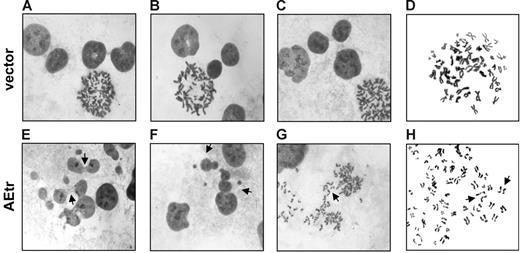 Figure 3. Abnormal morphology of interphase and mitotic AEtr cells. (A-C) Giemsa staining of interphase vector control nuclei. (D) Chromosome spread of a prometaphase vector control cell. (E) Giemsa staining of interphase AEtr nuclei. Arrows indicate chromosome bridges. (F) Polyploid AEtr interphase cells (indicated by arrows). (G) Lagging chromosomes (indicated by arrow) during anaphase of an AEtr cell. (H) Premature sister chromatid separation in an AEtr prometaphase cell. Images were captured with a Leica DMLB microscope with a 100×/_ oil objective and a Spot 2 digital camera (Diagnostic Instruments, Sterling Heights, MI) using Spot v.4.64 software. Images were processed with Adobe Photoshop 5.5 (Adobe Systems, San Jose, CA).