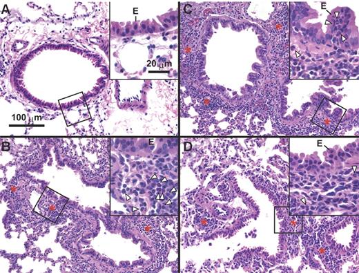 Figure 1. Antigen-induced neutrophilic airway inflammation in OTII mice. OTII mice were challenged with 50 μg of OVA (B-D) or PBS (A) intranasally for 3 days (once per day). Lung histology was performed in hematoxylin- and eosin-stained sections of formalin-fixed, paraffin-embedded tissues of mice that were killed 24 hours after the last OVA or PBS inhalation. Scale bars in photomicrographs and insets are 100 and 20 μm, respectively. Arrowheads indicate neutrophils; E, bronchiolar epithelium; asterisk, representative areas of peribronchiolar or perivascular inflammation; and area of section shown at higher magnification in the inset. Images were captured with a Nikon E1000M microscope (Nikon, Melville, NY) utilizing a 20×/0.75 NA objective and a 60×/0.95 objective for inserts (ocular eyepieces, 10×), a SPOT FLEX camera (Diagnostic Instruments, Sterling, MI) model 15.2, SPOT Advanced 4.5 software (Diagnostic Instruments), and Photoshop CS2 (Adobe Systems, San Jose, CA).