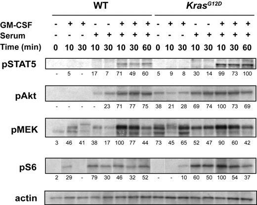 Figure 1. Phospho-protein levels in WT and Mx1-Cre, KrasG12D bone marrows. After 2 hours of serum starvation, total bone marrow cells were stimulated with GM-CSF, serum, or both for 10, 30, or 60 minutes. The cells were lysed and Western blotting was performed. Signal intensity normalized to actin is indicated below each panel, using arbitrary units. The figure shows representative data from 11 independent experiments.