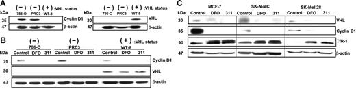 Figure 5. Cyclin D1 is down-regulated in confluent RCCs expressing pVHL, and both cyclin D1 and pVHL are down-regulated after Fe chelation. (A) Cyclin D1 is down-regulated in confluent cultures of human RCCs expressing pVHL. Western blot analysis of cyclin D1 and pVHL expression using confluent cultures of human parental RCCs (786-O); these cells either transfected with the VHL hyperexpression vector (WT-8) or this vector without the VHL insert (PRC3). (B) DFO and 311 down-regulate cyclin D1 protein regardless of pVHL status. The 786-O, WT-8, and PRC3 cells under partially confluent culture conditions were incubated with media alone (control) or media containing DFO (250 μM) or 311 (25 μM) for 24 hours. Western blot analysis was performed to detect cyclin D1 and pVHL expression. (C) DFO and 311 down-regulate pVHL and cyclin D1 but up-regulate TfR1 in a variety of cell types. MCF-7 breast cancer cells, SK-N-MC neuroepithelioma cells, and SK-Mel-28 melanoma cells were incubated with either media alone or media containing 311 (25 μM) or DFO (250 μM) over 24 hours, and Western analysis was performed. Results shown are a typical experiment from 3 performed.