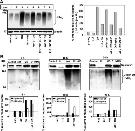 Figure 6. Iron chelators decrease general (Ub)n and cyclin D1 polyubiquination when proteasome activity is inhibited. (A) General protein polyubiquitination is decreased when cells are incubated with 311 in the presence of the proteasomal inhibitors MG or LC. MCF-7 cells were incubated with media alone or medium containing 311 (25 μM) in the presence and absence of MG (20 μM) or LC (10 and 20 μM) for 24 hours at 37°C. Total protein was extracted from cells and Western analysis was performed. (B) 311 decreases cyclin D1 protein expression and also decreases polyubiquitination of cyclin D1 in the presence of MG. MCF-7 cells were incubated with either media alone or media containing 311 (25 μM) in the presence and absence of MG (20 μM) for 8, 18, and 24 hours. Immunoprecipitation was performed using anti–cyclin D1 antibody. Complexes were then separated by SDS-PAGE and probed with anti–cyclin D1 or antiubiquitin antibody using Western analysis. Results shown are typical experiments from 3 performed. The horizontal broken line in the densitometric analysis represents a value of 100%.