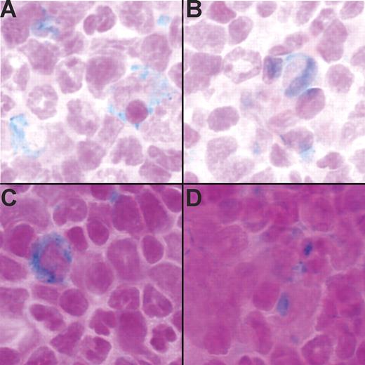 Figure 3. Tg+ mice have stainable iron in the bone marrow. (A-B) Prussian blue stain detected iron in the bone marrow of 2 Tg− mice. (C-D) Prussian blue stain detected iron in the bone marrow of 2 Tg+ mice. Run-to-run variation accounts for differences in the intensity of nuclear fast red counter stain.