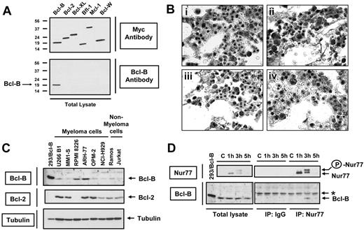 Figure 4. Endogenous Nur77 binds endogenous Bcl-B in cells of plasma cell lineage. (A) HEK293T cells were transfected with 1 μg plasmids encoding Myc-tagged Bcl-B, Bcl-2, Bcl-XL, Bfl-1, Mcl-1, and Bcl-W proteins. After 24 hours, cells were lysed and analyzed by SDS-PAGE/immunoblotting using anti-Myc (top blot) and anti–Bcl-B (bottom blot) antibodies. Molecular weight markers are shown in kilodaltons (kDa). (B) Immunohistochemical detection of Bcl-B in normal human bone marrow. Serial sections of bone marrow biopsy were stained with (i) preimmune serum, (ii) anti–Bcl-B antiserum, (iii) anti–Bcl-B antiserum preadsorbed with GST–Bcl-B, and (iv) anti–Bcl-B serum preadsorbed with Bcl-W peptide. Specimens were counterstained with nuclear red dye. Original magnifications are × 1000. (C) Lysates from various myeloma and nonmyeloma cell lines were analyzed by SDS-PAGE/immunoblotting using Bcl-B, Bcl-2, and tubulin antibodies. (D) RPMI 8226 cells were stimulated for 1, 3, or 5 hours with TPA (100 ng/mL) and ionomycin (1 μM). Lysates were prepared, and immunoprecipitation was performed with monoclonal anti-Nur77 monoclonal antibody or mouse IgG. Immunoprecipitates and lysates were analyzed by SDS-PAGE/immunobloting using anti-Nur77 (top blot) or anti–Bcl-B (bottom blot) antibodies. In panels C and D, “293/Bcl-B” represents lysate (20 μg) from HEK 293T cells transfected with plasmid encoding Bcl-B protein, used as a positive control. Asterisk indicates a nonspecific band. Phospho form of Nur77 is indicated by the circled P.
