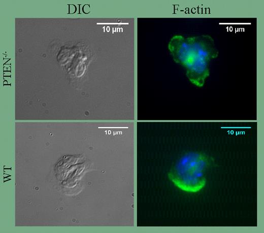 Formation of multiple pseudopodia in PTEN−/− neutrophils. See the complete figure in the article beginning on page4028.