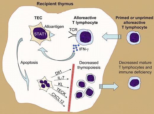 Illustration of how killing of thymic epithelial cells (TECs) by alloreactive T lymphocytes can lead to posttransplantation immune deficiency. Alloreactive primed or unprimed naive T lymphocytes enter the recipient thymus after HSCT. As a result of T-cell receptor–mediated recognition of alloantigens presented by the TECs, the alloreactive T cells secrete interferon-gamma (IFN-γ). The TEC response to interferon signaling includes activation of the STAT1 transcription factor, leading to an apoptotic program and TEC death. The loss of TECs results in defective microenvironmental support of thymopoiesis via numerous molecules such as the Notch ligand Dll1, the cytokines IL-7 and Kit ligand (KL), and the chemokines TECK and CXCL12. The resultant decrease in T-cell production ultimately leads to immune deficiency.