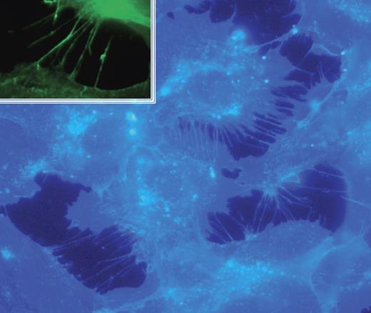 Figure 3. Bradykinin induces filopodia formation in endothelial cells. HUVECs were plated in serum-free medium containing growth factor supplement followed by the addition of bradykinin (15 minutes; 200 nM). Cells were fixed and stained with filipin; images were captured with a Zeiss Axioplan 2 (Thornwood, NJ) fluorescence microscope with 63×/1.4 NA oil objective, a Zeiss Axiocam HRC digital camera with plug-in v. 2.0 acquisition software, and processed with Photoshop 1 (Adobe, San Jose, CA). Inset shows immunofluorescence analysis of the filopodia marker fascin.