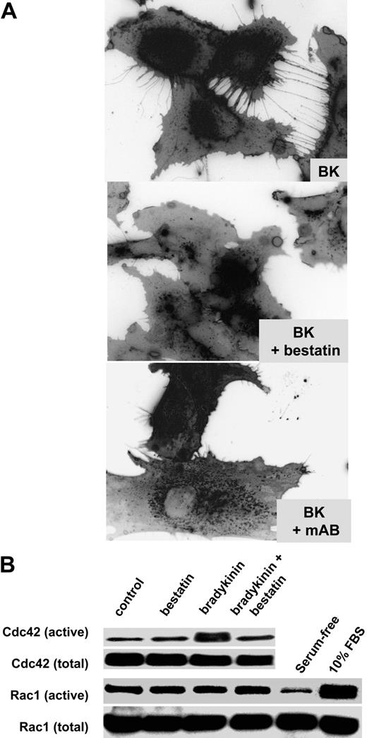 Figure 4. Suppression of CD13 activity inhibits bradykinin-induced filopodia formation. (A) HUVECs were trypsinized and replated with bradykinin in the presence or absence of bestatin (100 μg/mL) or MY7 antibody (CD13 mAb, 1:100 dilution) and stained with filipin as in Figure 3. (B) Bestatin (100 μg/mL) inhibits bradykinin signal transduction, resulting in inhibition of Cdc42 but not Rac activation in HUVECs.