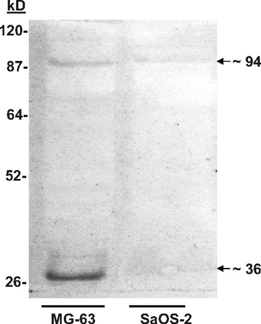 Figure 1. Cell blot–identified annexin II (Anxa2) expressed on osteoblasts (OBs) mediates adhesion of KG1a cells. SaOS-2 or MG-63 membrane lysates were run on native lithium dodecyl sulfate–polyacrylamide gels before being blotted onto polyvinylidene fluoride membranes.20,21 After blocking the membranes with bovine serum albumin (BSA), the membranes were probed with biotin-labeled KGla cells for 2 hours at 37°C. The membranes were then fixed and the location of the cells identified with streptavidin-conjugated horseradish peroxidase. The figure is presented as an enhanced image for visualization. (The original figure is provided in Figure S1, available on the Blood website; see the Supplemental Figures link at the top of the online article.) Adhesion of the biotin-labeled KG1a cells to proteins in the MG-63 membrane lysates revealed a band at approximately 36 and approximately 94 kDa.
