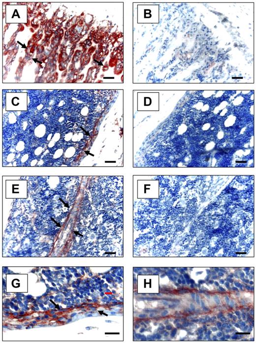 Figure 2. Expression of Anxa2 protein in murine long bones. Mouse tibias were fixed in 10% formalin at 4°C before being decalcified in 10% EDTA (pH 7.4) and embedded in paraffin wax. Immunolocalization of Anxa2 protein (arrows) was visualized using a monoclonal antibody that was raised against Anxa2 or an IgG control antibody and a 9 ethyl-carbazole chromogen kit. Anxa2-immunostained tibias (20 × magnification) (A,C,E) and control immunoreactivity (B,D,F). Scale bars represent 50 μm. (A-B) Anxa2 expression at the epiphyseal growth plates. (C-D) Anxa2 expression in the diaphysis regions. (E-F) Anxa2 expression in bone marrow endothelial cells. (G-H) Higher magnification of panels C and E. Images at 20× (A-F) and 40× (G, H) via a 0.75 NA oil objective. A Nikon E800 (Diagnostic Instruments, Sterling Heights, MI) camera and Image-Pro Plus software (MediaCybernetics, Bethesda, MD) were used.