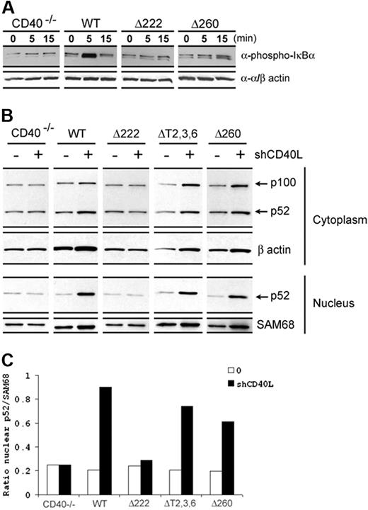 Figure 2. CD40 induced NFκB activation. (A) CD19+ splenic B cells purified from different CD40 transgenic mice were cultured in vitro with hCD40L (1 μg/mL) stimulation for indicated time points. Canonical NFκB activation was measured by phosphorylated IκBα blotting. Anti-α/β actin antibody was used for loading control. (B) For noncanonical NFκB activation, B cells were cultured in 24-well plates and stimulated with 1 μg/mL hCD40L for 16 hours. Cells were then harvested and cytoplasmic and nuclear fractions were isolated. The level of noncanonical NFκB activation was detected by p52 blotting in the nuclear fraction. Anti-SAM68 antibody was used for loading control. Data are representative of more than 3 independent experiments. (C) The ratio of intensity values of p52 and SAM68 signals from the nucleus fraction was presented as quantitative analysis for measuring noncanonical NFκB activation.
