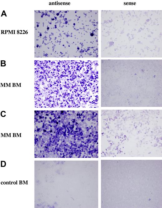 Figure 3. Ptn gene expression is up-regulated in myeloma cells. In situ hybridization demonstrated that Ptn was transcribed by the myeloma cell line RPMI 8226 (A right) and the BMMCs from 2 different myeloma patients (B and C right). In contrast, staining of the BMMCs from a healthy donor (D right) was equivalent to the staining by the negative control sense probes (A-D left).