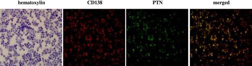 Figure 4. PTN protein is expressed by CD138 + cells in the BM from myeloma patients. BMMCs were stained for PTN73 and CD138 (red). The merged image (right) localized PTN to the CD138 + cells.