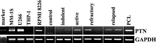 Figure 6. Ptn gene expression correlates with disease status in myeloma patients. Mononuclear cells from BM of a MM patient or a healthy donor, PBMCs from a plasma cell leukemia patient, and the myeloma cell lines RPMI 8226, U266, and MM-1S, and the human monocytic cell line THP-1 were analyzed for Ptn gene expression by RT-PCR. Ptn transcripts were not detected in THP-1 cells, or healthy control BM, and only minimally in a patient with indolent MM. In contrast, Ptn was expressed more highly by myeloma patients with active, refractory, or relapsed disease. The highest level of Ptn expression was detected in the malignant cells from a patient with plasma cell leukemia and the myeloma cell lines RPMI 8226, U266, and MM-1S.