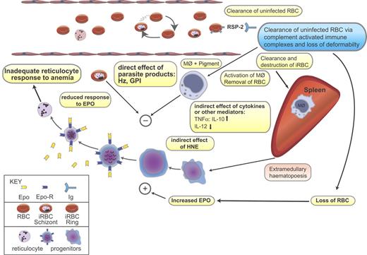 Figure 3. Direct and indirect effects of parasite on the development of malarial anemia. Severe malarial anemia is characterized by destruction of infected red blood cell (iRBC) following schizogony and clearance of both iRBCs and uninfected RBCs. During malarial infection, changes in membrane protein composition occur and the resultant immune complexes of RBCs, Ag, and immunoglobulin (Ig) (eg, RBC:RSP2:Ig) are cleared by macrophages to the spleen where they become activated (see Table 3 for more examples). Pigment-containing macrophages may release inflammatory cytokines and other biologically active mediators such as hydroxy-nonenal (HNE). It is possible that malarial pigment or other parasite products may have a direct inhibitory effect on erythropoiesis. Inhibition of erythropoiesis may be at one or more sites in the growth and differentiation of hematopoietic progenitors. Both indirect and direct effects may cause suppression of the bone marrow and spleen resulting in inadequate reticulocyte counts for the degree of anemia. The mechanisms of insufficient erythropoiesis in murine malaria have been summarized in Chang and Stevenson.154 Blue box indicates demonstrated in human infection; pink box, demonstrated in mouse infection; yellow box, demonstrated in both human and mouse infections. Hz indicates hemozoin; GPI, glycophosphatidylinositol anchors of merozoite proteins; Epo, erythropoietin; Epo-R, erythropoietin receptor; MΦ, macrophage; RSP-2, ring surface protein-2; and Ig, immunoglobulin. Figure modified with permission from Springer Science Business Media, Heidelberg, Germany.