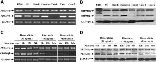 Figure 2. Rituximab combined with doxorubicin down-regulated PRDM1β expression. B-lymphoma cell lines and primary DLBCL cells expressed PRDM1α and PRDM1β both at transcriptional (A) and protein levels (B). Combined treatment of doxorubicin and rituximab reduced PRDM1β expression (C-D).