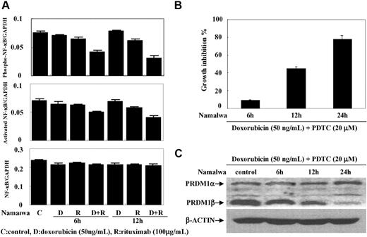 Figure 3. Rituximab combined with doxorubicin decreased NF-κB activity. Rituximab combined with doxorubicin significantly decreased the phosphorylated and the activated forms of NF-κB (P65) in Namawa cells, without variation of total NF-κB (A). Addition of NF-κB inhibitor PDTC increased the antiproliferative effect of doxorubicin on Namawa cells (B) and induced PRDM1β down-regulation (C).