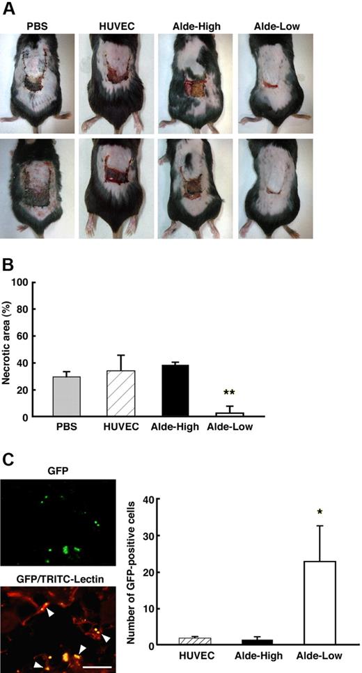Figure 5. Alde-Low EPCs were curative of ischemic tissue. (A) Skin incisions were created on the dorsal surfaces of mice, and PBS alone, HUVECs, Alde-High EPCs, or Alde-Low EPCs were injected (top and bottom photographs/each condition). The effectiveness of ECs to recover tissue from ischemia was examined on day 7 following surgery. (B) The necrotic regions in the 4 types of mice (n = 3) were measured. Note that the area of necrosis was smallest in the mice injected with Alde-Low EPCs. Gray bar indicates PBS; striped bar, HUVECs; black bars Alde-High EPCs; and white bar, Alde-Low EPCs. **P < .01. (C) Neovascularization was examined in the region of the incision after the injection of Alde-Low EPCs. Newly formed vessels were analyzed for the detection of GFP-positive Alde-Low EPCs (GFP; top) and whole vessel formation by TRIC-conjugated lectin (GFP-TRIC-Lectin; bottom). The colocalization of GFP-positive EPCs and TRIC-positive fine capillaries can be observed (GFP-TRIC-Lectin, arrowheads). The numbers of GFP-positive HUVECs, Alde-High EPCs, and Alde-Low EPCs that had migrated to the dorsal skin were scored on the seventh day after surgery (left). *P < .05. Bar indicates 100 μm.