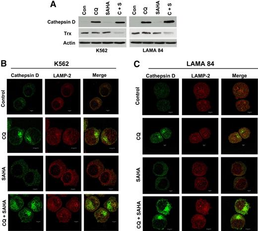 Figure 6. Chloroquine and SAHA increase the expression and alter the subcellular localization of cathepsin D and reduce the levels of its substrate thioredoxin (Trx). (A) Drug-induced modulation of cathepsin-D and Trx expression. K562 and LAMA 84 CML cells were treated with 25 μM CQ, 2 μM SAHA, or the combination for 24 hours. Immunoblotting was used to evaluate cathepsin-D and Trx expression. Actin was used as a loading control. (B-C) Subcellular localization of cathepsin D. K562 (B) and LAMA 84 (C) cells were treated with 25 μM CQ, 2 μM SAHA, or the combination for 18 hours. Cells were centrifuged at 150g onto glass slides and stained with anti–cathepsin-D and anti–LAMP-2 (lysosomal marker) antibodies as described in Confocal Microscopy in “Patients, materials, and methods.” Cells were visualized by confocal microscopy. Magnification, × 40.