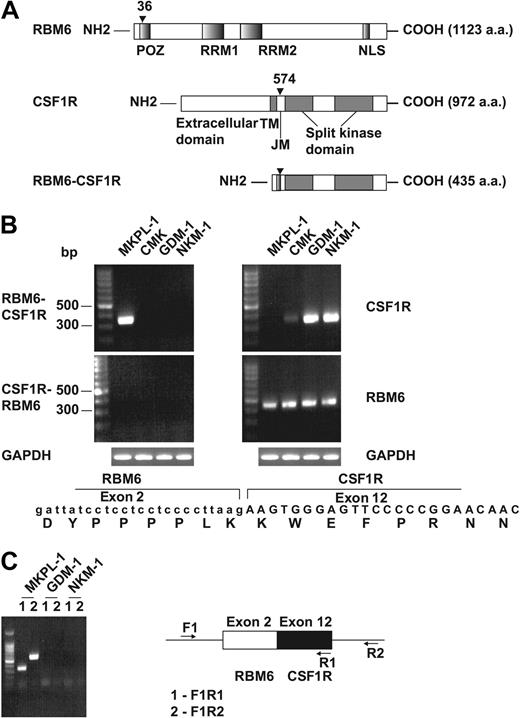 Figure 3. Detection of the fusion gene formed by the genes for RNA binding motif 6 (RBM6) and colony stimulating factor 1 receptor (CSF1R). (A) Schematic diagram shows the RBM6, CSF1R, and RBM6-CSF1R proteins. The position of the breakpoint is indicated by arrowhead. POZ indicates poxvirus and zinc finger domain; RRM1 and RRM2, RNA recognition motif 1 and 2, respectively; TM, transmembrane; JM, juxtamembrane; and NLS, nuclear localization signal. (B) RT-PCR reaction indicated a fusion of RBM6 to CSF1R in RNA from MKPL-1 cells. GAPDH was used as a control. The sequence from junction of the fusion gene is listed at the bottom. (C) Genomic PCR reaction detected the RBM6-CSF1R fusion gene in DNA.