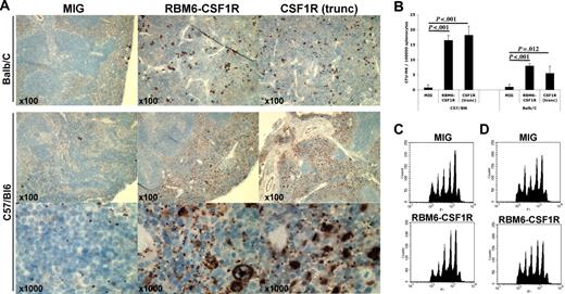 Figure 6. The RBM6-CSF1R–induced megakaryocyte phenotype is mouse-strain specific. (A) Immunohistochemistry on spleen section using von Willebrand factor antibody. Note that both megakaryocyte and platelet numbers are increased in the C57/Bl6 background, whereas only megakaryocytes numbers are increased in the Balb/C background. (B) Splenocytes were plated in collagen-based media containing TPO, IL-11, IL-3, and IL-6. Slides were stained for acetylcholinesterase and colonies were enumerated. Experiment was performed at least in triplicate and mean ± SD is represented. CFU-MK indicates colony-forming unit–megakaryocyte. Bone marrow cells from C57/Bl6 (C) or Balb/C (D) recipients were cultured for 4 days in presence of TPO and SCF. Cells were then stained with propidium iodide (PI) and CD41+ cells were analyzed for ploidy content.