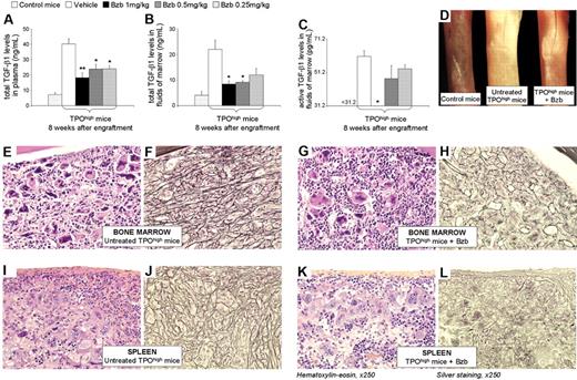 Figure 3. Bortezomib impairs marrow and spleen fibrosis development in TPOhigh mice through TGF-β1 inhibition. (A-C) Bortezomib decreases (A) TGF-β1 plasma levels and (B) the total form of TGF-β1 as well as (C) its active form in extracellular fluids of marrow of TPOhigh mice in a dose-dependent manner with respective P(DE) values ≤ .001, .010, and ≤ .001. Total TGF-β1 (active + latent forms) levels were quantified in (A) plasma and in (B) extracellular fluids using an ELISA after acidification of the sample. (C) Active TGF-β1 levels in extracellular fluids were determined without acidification. Note that the media supplemented with 10% fetal calf serum (FCS) used to prepare extracellular fluids of bone marrow contain less than 1.5 ng/mL TGF-β1 and no active form. No spontaneously active TGF-β1 was detected before acidification of the plasma samples. Results in plasma and in extracellular fluids are presented as the mean ± SEM of 12 (except for the “1 mg/kg” group that included only 6 surviving mice at week 8) and of 3 animals per experimental group, respectively (similar results were obtained in 3 other animals per experimental group at week 16 after engraftment, except for the “1 mg/kg” group). Results of statistical analysis with the Wilcoxon test are as follows: treated (bortezomib 0.25 mg/kg, 0.5 mg/kg, and 1 mg/kg) versus untreated (vehicle) mice; *P < .05; **P < .001. Bzb indicates bortezomib. (D-L) Bortezomib impairs marrow and spleen fibrosis development in TPOhigh mice after 4 weeks of treatment (8 weeks after engraftment). (D) Representative femora of control mice (left), untreated (vehicle) TPOhigh mice (middle), and treated (bortezomib 0.5 mg/kg) TPOhigh mice (right). Image was obtained using an Olympus SZX12 stereomicroscope with 1.2× objective (magnification × 8.4), a DP50 Olympus digital camera and the analySIS© acquisition software (Olympus, Tokyo, Japan). Representative histologic sections of femora (E-H) and spleen (I-L) from treated (bortezomib 1 mg/kg; G-H, K-L) or untreated (vehicle; E-F, I-J) TPOhigh mice are shown. Bone marrow and spleen sections stained by hematoxylin and eosin show the hyperplasia of megakaryocytes and granulocytes in both treated (G, K) and untreated (E, I) mice. Silver staining reveals (F) marrow and (J) spleen fibrosis in untreated mice with reticulin fibers surrounding the megakaryocytes. Bortezomib treatment impairs reticulin deposition in both bone (H) marrow and (L) spleen. Original magnification × 250.