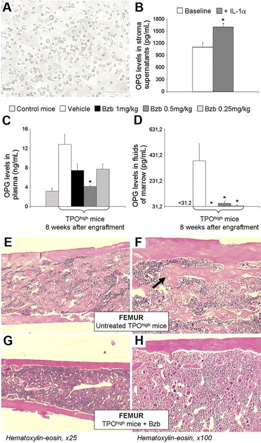 Figure 4. Bortezomib impairs osteosclerosis development in TPOhigh mice through OPG inhibition. (A) Adherent murine stromal cell layers were observed by light microscopy. The scale bar is 50 μm. (B) IL-1α stimulates OPG secretion by stromal cells. OPG levels were quantified in murine stromal cell culture supernatants, with or without IL-1α stimulation for 24 hours, using an ELISA. Results are presented as the mean ± SEM of 5 different adherent stromal cell layers. Results of statistical analysis with the Wilcoxon test are as follows: stimulated (IL-1α 5 ng/mL) versus unstimulated (baseline); *P < .05. (C-D) Bortezomib decreases OPG levels in both plasma and extracellular fluids of marrow in TPOhigh mice regardless of dosage. OPG levels were quantified in (C) plasma and in (D) extracellular fluids using an ELISA. Results in plasma and in extracellular fluids are presented as the mean ± SEM of 12 (except for the “1 mg/kg” group that included only 6 surviving mice at week 8) and of 3 animals per experimental group, respectively (similar results were obtained in 3 other animals per experimental group at week 16 after engraftment, except for the “1 mg/kg” group). Results of statistical analysis with the Wilcoxon test are as follows: treated (bortezomib 0.25 mg/kg, 0.5 mg/kg, and 1 mg/kg) versus untreated (vehicle) mice; *P < .05. Bzb indicates bortezomib. (E-H) Bortezomib dramatically impairs osteosclerosis development in TPOhigh mice after 12 weeks of treatment (16 weeks after engraftment). Representative histologic sections of femora stained by hematoxylin and eosin from untreated (vehicle) TPOhigh mice (E-F) show osteosclerosis development with accumulation of bone trabeculae in the medullar cavity (arrow). Bortezomib treatment (0.5 mg/kg) impairs considerably new bone formation (G-H). Original magnification × 100 (F, H), × 25 (E, G).