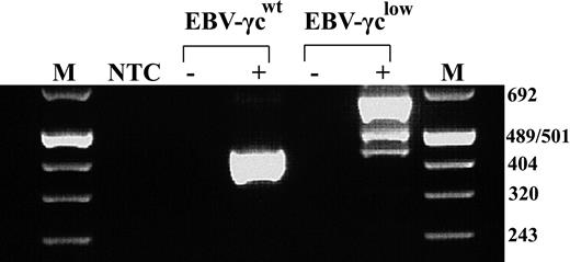 Figure 1. EBV-transformed patient cells exhibit the same aberrant γc mRNA splicing pattern as previously studied patient PBMCs. RT-PCR analysis showed a single 439 bp product representing correctly spliced γc mRNA in healthy control-derived EBV-γcwt cells (lane 4) and 3 products of 439, 499 and 650 bp in patient-derived EBV-γclow cells (lane 6). These represent trace amounts of correctly spliced γc mRNA, a species with aberrant intron 3 splicing and a predominant species with complete failure of intron 3 splicing, respectively. M indicates Molecular Weight Marker VIII (Roche); NTC, no template control; EBV-γcwt, healthy control; EBV-γclow, patient; -, no RT controls.