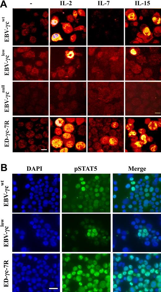 Figure 3. Detection of γc-dependent cytokine signaling by immunocytochemical analysis of STAT5 phosphorylation in EBV-transformed B and ED-γc-7R cell lines. (A) Single xy plane confocal images of EBV-γcwt, EBV-γclow, EBV-γcnull, and ED-γc-7R cell lines labeled with anti-pSTAT5 antibody in the absence (column 1) or presence of IL-2 (5 nM), IL-7 (100 nM), or IL-15 (10 nM or 100 nM) (columns 2, 3, and 4, respectively). Scale bar represents 10 μm. (B) Immunofluorescence images of EBV-γcwt, EBV-γclow, and ED-γc-7R cell lines cells showing nuclear localization of pSTAT5 after IL-15 stimulation (100 nM). Cells labeled with DAPI (column 1), pSTAT5 (column 2), and merged images (column 3). Scale bar represents 20 μm.