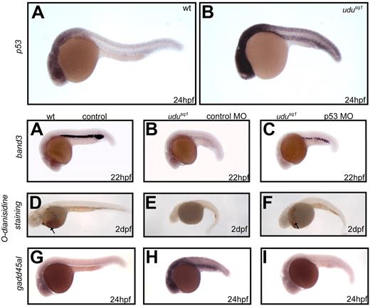 Figure 6. Up-regulation of p53 activity partially contributes to the erythroid phenotype in Udusq1−/− mutants. (A-B) WISH shows that p53 expression is elevated in 24-hpf Udusq1−/− embryos (B) compared with wild-type (A). (C-E) WISH of band3 in 22-hpf wild-type embryos (C) and Udusq1−/− mutant embryos injected with control MO (D) or p53 MO (E). (F-H) o-dianisidine staining of 2-dpf wild-type embryo (F) and Udusq1−/− mutant embryos injected with control MO (G) or p53 MO (H). (I-K) WISH of gadd45αl in 24-hpf wild-type embryos (I) and Udusq1−/− mutant embryos injected with control MO (J) or p53 MO (K). All embryos are in lateral views with anterior to the left. Arrows in panels F and H indicate o-dianisidine–stained red blood cells.