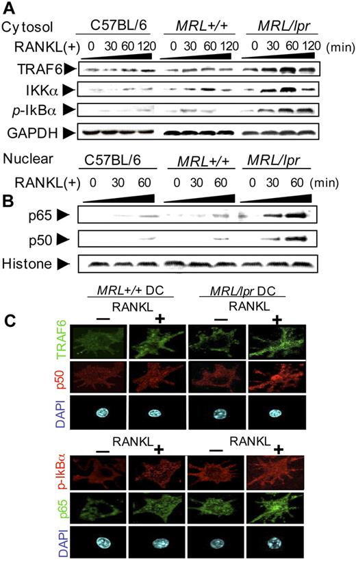 Figure 3. RANKL signaling molecules in MRL/lpr DCs. (A) The expressions of TRAF6, IKKα, and phospho-IκB (pIκB) of RANKL-stimulated BMDCs from C57BL/6, MRL+/+, and MRL/lpr mice were detected using the cytoplasmic extracts by Western blot analysis. The BMDCs were stimulated with RANKL (100 ng/mL) from 0 to 120 minutes. GAPDH was used as a housekeeping protein. (B) Nuclear translocation of NF-κB (p65 and p50) of RANKL-stimulated BMDCs from C57BL/6, MRL+/+, and MRL/lpr mice was detected by immunoblot. Histone was used as a housekeeping protein of the nuclear extracts. (C) Increased TRAF6 and p-IκB in the cytoplasm, and accelerated nuclear translocation of p50 and p65 in the nucleus of RANKL-stimulated MRL/lpr DCs were detected by confocal microscopic analysis. BMDCs from MRL/lpr and MRL+/+ mice were stimulated for 48 hours with or without RANKL, fixed in 3% PFA on a glass slide, and stained with anti-p65, anti-p50, TRAF6, and p-IκBα followed by Alexa Fluor 488–labeled (green) or Alexa Fluor 568–labeled (red) anti-mouse or anti-rabbit IgG as the second antibodies. The nuclei were stained with DAPI. Original magnification, × 630. All data are representative of 3 to 5 independent experiments.
