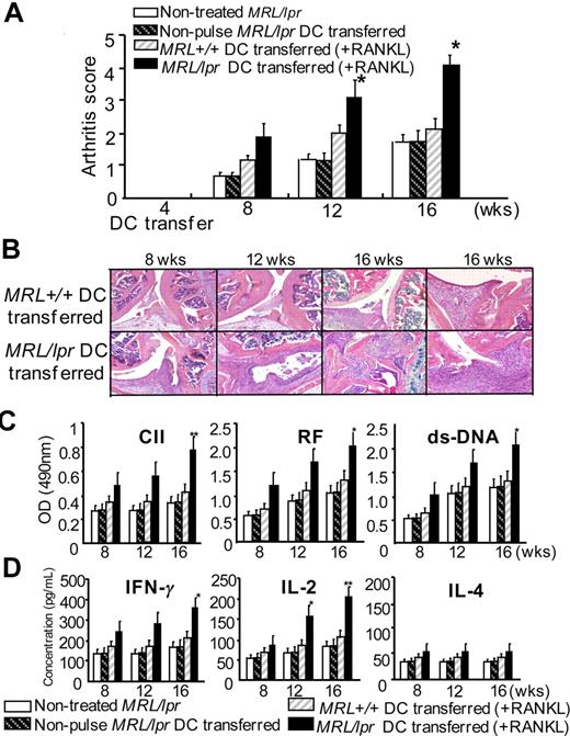Figure 7. Effects of the RANKL-stimulated MRL/lpr DCs transfer on autoimmune arthritis. BMDCs pulsed with CII and stimulated with RANKL were transferred into MRL/lpr recipients (4 weeks of age). The recipient MRL/lpr mice were analyzed at 8 to 16 weeks of age. (A) Histologic score of autoimmune arthritis in MRL/lpr mice transferred with RANKL-stimulated MRL/lpr DCs was evaluated compared with control mice until 16 weeks of age. Data are means ± SD of 5 to 7 mice in each group. *P > .05; **P > .01, MRL+/+ DCs versus MRL/lpr DCs transferred. (B) Histologic analysis of autoimmune lesions from MRL/lpr mice transferred with RANKL-stimulated MRL/lpr DCs and MRL+/+ DCs at 8, 12, and 16 weeks of age was performed. The sections of joints from the recipients were stained with HE. Data are representative of 5 to 7 mice in each group. (C) RF, anti-CII antibodies, and anti-dsDNA antibodies of sera from the recipients at 16 weeks of age were detected by ELISA. (D) The secretions of IFNγ, IL-2, and IL-4 in the supernatants from ILN T cells stimulated with anti-CD3 mAb were detected by ELISA. Data are means ± SD of triplicate samples and are representative of 5 to 7 mice in each group. *P > .05; **P > .01, MRL+/+ DCs versus MRL/lpr DCs transferred.
