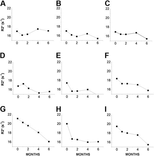 Figure 2. R2* values of dentate nuclei of 9 individual FA patients undergoing treatment with deferiprone (20-30 mg/kg/d) for up to 6 months. Mean R2* constants (in s−1) of dentate nuclei of individual FA patients (A-I) were obtained at the indicated month of treatment (1- to 2-month intervals) as described in “Patients, materials, and methods.”