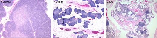 Figure 5. Thymic histology. Hemotoxylin and eosin stains of the thymus of 3 representative animals at necropsy 12 to 14 months after transplantation. Thymus (left panel) scored as grade 1: well-preserved architecture with well-defined cortex and medulla, no atrophic changes. Grade 2 thymus (middle panel): some degree of atrophic changes consisting of fat replacement of lobules and preservation of cortex and medulla and islets of cell-dense tissue containing many thymocytes. Grade 3 thymus (right panel): marked atrophic changes and cystic degeneration. All photos were taken with an Olympus BX41 microscope, objective 4 × /0.13 UPlanFl.