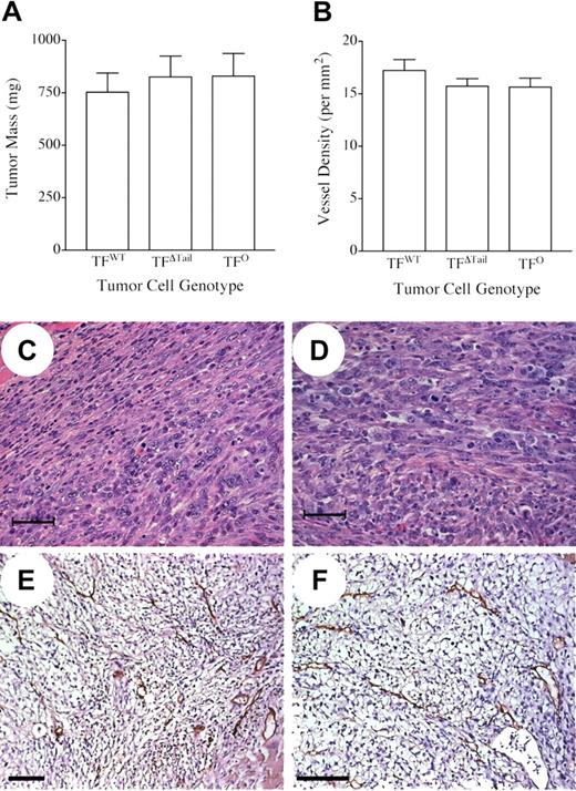 Figure 2. Tumor cell-associated TF expression is not required for tumor growth or tumor angiogenesis. (A) Weight of tumors formed 18 days after injection of 5 × 105 TFWT, TFΔTail, or TFO tumor cells into the dorsal subcutis of wild-type C57Bl/6 mice (n = 9 for each tumor cell genotype). Note that there is no significant difference in tumor mass, regardless of the presence, absence, or form of tumor cell–associated TF. (B) Comparative analysis of vascular density in subcutaneous tumors harvested 18 days after injection of TFWT, TFΔTail, or TFO tumor cells. Tumor tissue sections (n = 3-4 per tumor cell genotype) were stained with an anti-CD31 antibody and vessels were enumerated within 10 200× fields. Note that no significant difference in vessel density was observed in any pair-wise comparison of cohorts. The error bars in (A) and (B) indicate the SEM. (C-F) Microscopic appearance of tumor sections prepared from primary tumors established with TFWT, TFΔTail, and TFO tumor cells. Representative TFWT (C and E) and TFO (D and F) tumors sections processed for hematoxylin/eosin staining (C and D) or processed for immunohistochemical detection of the endothelial cell marker, CD31 (brown precipitate) (E and F). The scale bars indicate 50 μm (C and D) or 100 μm (E and F).