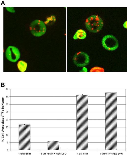 Figure 1. Cytoplasmic HES-DFO does not block 59Fe2-Tf incorporation into heme. Reticulocytes were exposed to transient lysis and resealing, as described in Experimental Procedures. (A) Cells were resealed in the presence of FITC-dextran (green), treated with MitoTracker CMXRos (red), and evaluated by confocal microscopy. (B) Cells were resealed in the absence or presence of 1 mM HES-DFO and then treated with either 1 μM 59Fe-SIH2 or 1 μM 59Fe2-Tf for 2.5 hour at 37°C. Heme and nonheme fractions were separated, measured by gamma counting, and the percentage of cell-associated 59Fe in heme was plotted. Error bars represent standard deviations (n = 3).