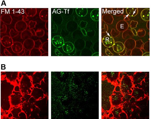 Figure 5. In reticulocytes, all plasma membrane-derived, intracellular structures contain transferrin. Cells were visualized by confocal microscopy. (A) Reticulocytes were treated with FM 1-43 and subsequently incubated at 37°C in the presence of AG-Tf. R, reticulocyte; E, erythrocyte; arrows, collocalized FM 1-43 and Tf. Scale bar is 5 μm. (B) Huh7 cells were treated with FM 1-43 and then with AG-Tf, as in panel A. To visualize the internalized dye, it was required to increase the photomultiplier tube gain to levels that elicit saturation of the dense, membrane signal surrounding these thin, adherent cells. Arrows indicate FM 1-43 vesicles that do not contain Tf. Scale bar is 10 μm.
