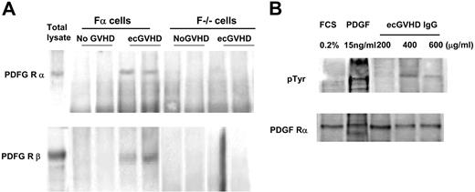 Figure 2. Immunoglobulins from patients with ecGVHD immunoprecipitate and phosphorylate PDGF receptor. (A) Fα and F−/− lysates were immunoprecipitated with IgG purified from extensive cGVHD patients (ecGVHD) and patients without GVHD (No GVHD). The filters were developed with specific antibodies against the PDGFR α and β subunits (WB). Total lysates indicate immunoblots of total proteins. Representative results from 1 of 3 experiments are shown. (B) Normal human fibroblasts were stimulated with different concentrations of IgG from patients with ecGVHD (15 minutes), PDGF (15 ng/mL for 15 minutes), or grown in 0.2% fetal calf serum. Cell lysates were immunoprecipitated with a polyclonal antibody against PDGFR (subunit α), and the immunoblots were developed with a specific antibody against phosphorylated tyrosine. FCS indicates fetal calf serum.