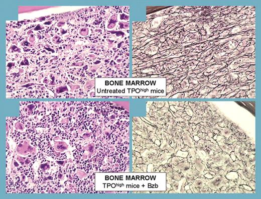 Bortezomib impairs marrow and spleen fibrosis development in TPOhigh mice through TGF-β1 inhibition. See the complete figure in the article beginning on page 345