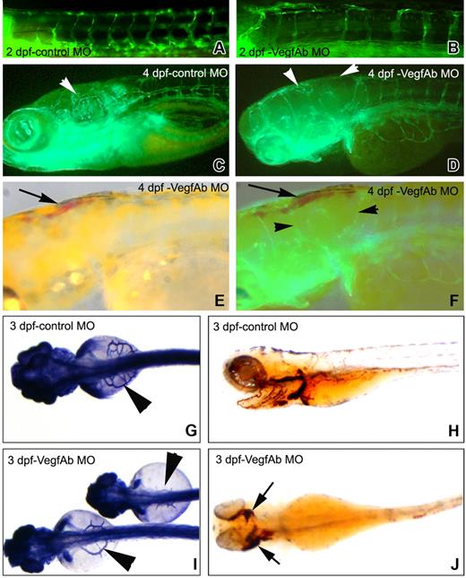 Figure 4. Vascular defects in VegfAb morphants. (A) Photomicrograph of a 5-bp mismatch vegfAb morpholino–injected (4.5 ng) fli1-gfp embryo at 2 dpf demonstrates no vascular defects (only one shown, although no phenotype was seen with either). (B) Defects in the formation of the ISVs anteriorly are clearly visible beginning at 2 dpf. (C) Photomicrograph of a 5-bp mismatch vegfAb control morpholino–injected (4.5 ng) fli1-gfp embryo at 4 dpf for comparison. (D-F) Beginning at 3 dpf, the number of circulating RBCs gradually decreased in 63% (162/255) of the embryos injected with 4.5 ng of the vegfAb ATG morpholino and in 47% (74/156) with 9 ng of the vegfAb-75 (5′UTR) morpholino (day-4 embryos are shown). Injection of an equivalent amount of 5-bp mismatch morpholinos did not affect vasculogenesis, and coinjection of the active vegfAb-75 (5′UTR) morpholino together with 50 pg each of vegfAb171 and vegfAb210 RNA reduced the number of embryos with defects in vasculogenesis by more than 50% (8/32 vs 22/40 abnormal embryo). VegfAb morphants showed decreased intersegmental vessel number and size (, ◀ in panels D and F) and aberrant head vascular development. SIVs were severely reduced in number, size, and branching that was more pronounced anteriorly. (E) At 4 dpf, blood is apparent in the head and anterior embryos (), which (F) corresponds to the areas with defects in angiogenesis. (G) Control morpholino–injected embryos demonstrate normal subintestinal vein (SIV) architecture by alkaline phosphatase staining, and (H) RBCs are shown by staining with o-dianisidine that stains hemoglobin reddish/brown. However, (I) injection of either morpholino targeting VegfAb leads to SIVs that are erratically placed and thin or nearly completely absent (only the start codon morpholino is shown) and (J) extravasation of RBCs in various structures, which is more pronounced anteriorly where the angiogenic defects are most visible (B-F). The results are combined from at least 3 separate experiments, and the photomicrographs are representative of the visible defects.