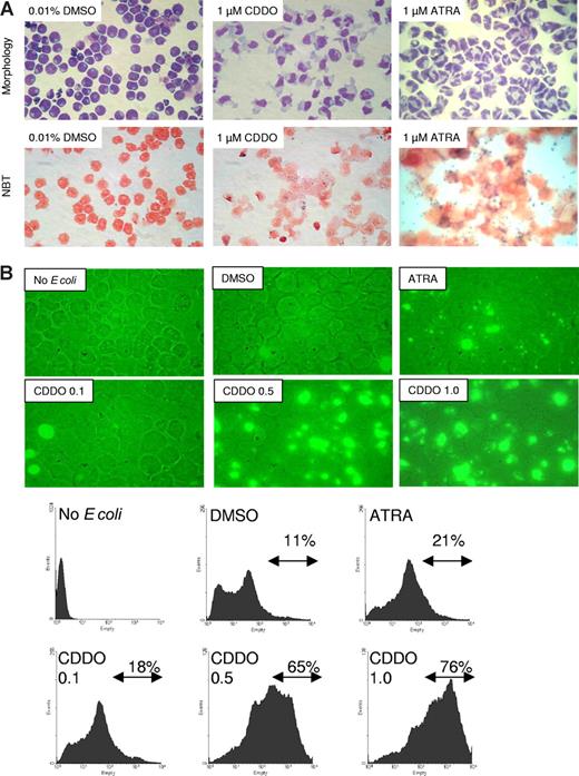 Figure 1. CDDO induces granulocytic-monocytic differentiation and phagocytic activity of HL60 cells. (A) Wright-Giemsa stain (top panel) and NBT assay (bottom panel) of HL60 cells after 4 to 5 days of culture. The cells were cultured in the presence of either 0.01% DMSO (vehicle), 1 μM ATRA, or 1 μM CDDO. (B) HL60 cells were cultured in the presence of either 0.01% DMSO, 1 μM ATRA, or 0.1 to 1 μM CDDO for 2 days prior to incubation with FITC-labeled E coli for 1 hour and analyzed for FITC positivity using fluorescence microscopy (top panel) or flow cytometry (bottom panel). The percentage of FITC-positive cells as detected by flow cytometry is indicated.